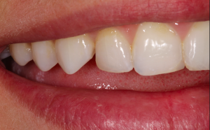 Screen Shot 2015-04-01 at 15.44.13